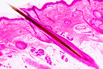 Education anatomy and physiology of Human scalp show of hair folticles under the microscopic in...