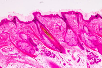 Education anatomy and physiology of Human scalp show of hair folticles under the microscopic in...
