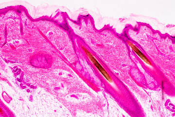 Education anatomy and physiology of Human scalp show of hair folticles under the microscopic in...