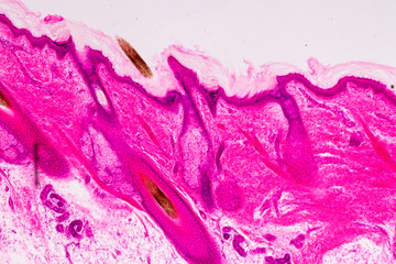 Education anatomy and physiology of Human scalp show of hair folticles under the microscopic in laboratory.