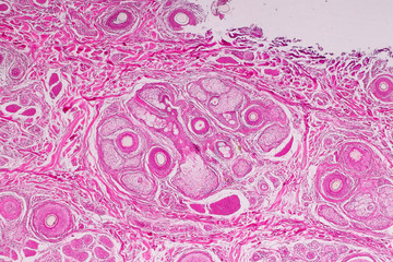 Education anatomy and physiology of Human scalp show of hair folticles under the microscopic in laboratory.