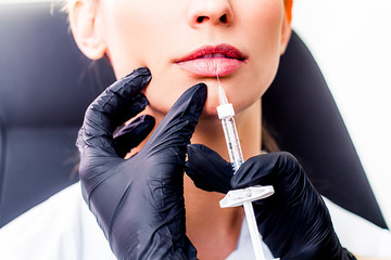 Lip augmentation procedure close up. The doctor injects an injection into the lips with a syringe.
