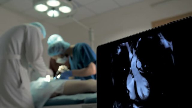 Monitoring of ECG and saturation O2 in the patient in the operating room