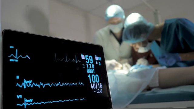 Monitoring of ECG and saturation O2 in the patient in the operating room