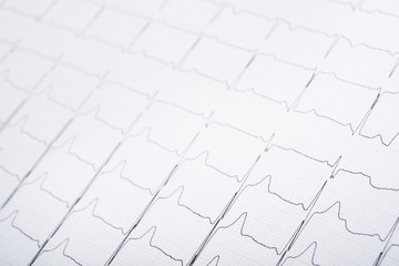 Closeup photo of ECG cardiogram
