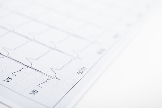 Closeup photo of ECG cardiogram