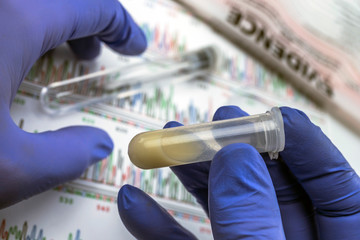 Expert police examines semen for DNA evidence, conceptual image