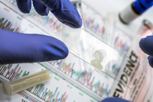 Expert police examines semen for DNA evidence, conceptual image