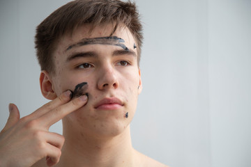Acne on the face of a teenager.
