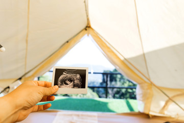 Hand holding Ultrasound images