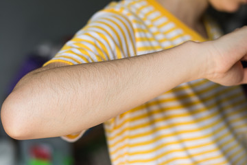 skin in close-up view with swell hears on it,drops arm hairs