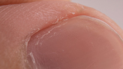 Obraz na płótnie Canvas Macro photo of big finger nail. Cuticles manicure