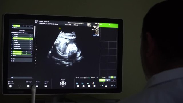 Doctor does ultrasound screening of pregnant woman. 4K