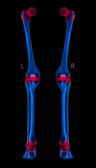 X-ray of Human Leg bone posterior view red highlights in arthritis leg joint pain area- 3D Medical and Biomedical illustration- Healthcare- Human Anatomy and Medical Concept- Blue tone color