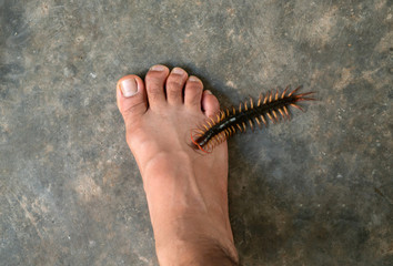 People were bitten by a centipede on their feet