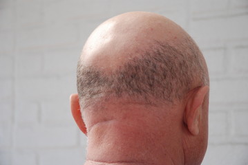 Old man's back of the head