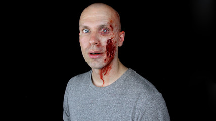 Male Trauma 2