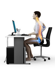 3d rendered medically accurate illustration of an office workers painful back