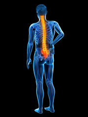 3d rendered medically accurate illustration of a mans painful back