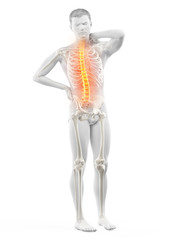 3d rendered medically accurate illustration of a mans painful back