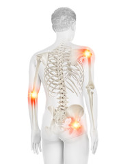 3d rendered medically accurate illustration of a mans painful joints