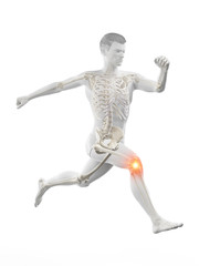 3d rendered medically accurate illustration of a runners painful kee