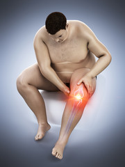 Naklejka premium 3d rendered medically accurate illustration of an obese mans painful knee