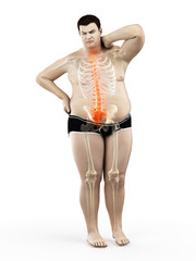 3d rendered medically accurate illustration of an obese mans painful back