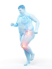 3d rendered medically accurate illustration of an obese runners painful joints