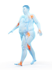 3d rendered medically accurate illustration of an obese runners painful joints