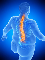 3d rendered medically accurate illustration of an obese mans painful back