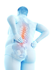 3d rendered medically accurate illustration of an obese mans painful back