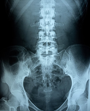 X-ray of pelvic bones and vertical human column.