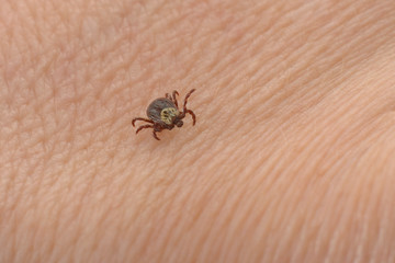 Tick is crawling on human body skin