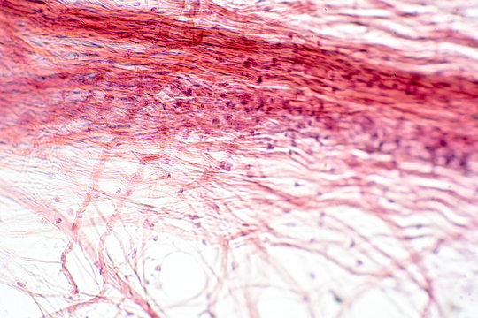 Соединительная ткань под микроскопом Гистологические окраски 2 Anatomy art, Scientific illustration, Medical school s
