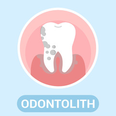 Odontolith Treatment, Stomatology Vector Banner