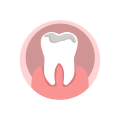 Hole in Tooth, Dental Problem Vector Illustration