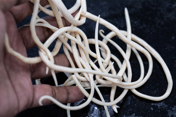 Ascariasis is a disease caused by the parasitic roundworm Ascaris lumbricoides for education in...