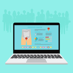 Prostatitis. Prostatic hyperplasia. Medical infographic set elements and symbols for design. Vector illustration
