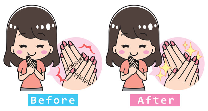 Finger hair hand care young woman