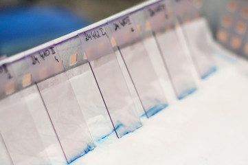 Laboratory equipment close-up