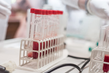 Close-up test tubes rack