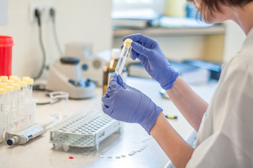 Scientist working in laboratory, close-up gloves with test-tube