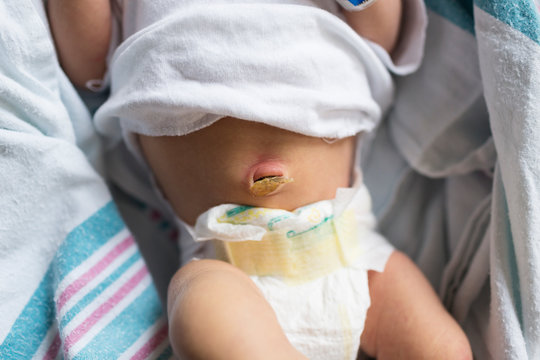 Overhead Newborn Belly Button With Umbilical Cord Still Attached