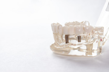 Obraz na płótnie Canvas Artificial teeth on a white background with copy space, close-up