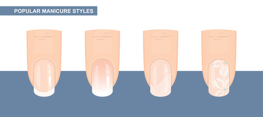 Most Popular Nail Designs. Manicure styles. Vector Illustration