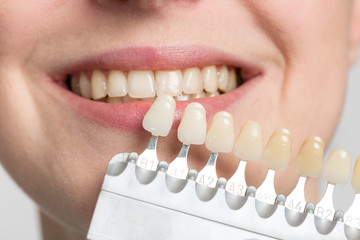 dentist using a shade guide at woman's mouth to check veneer of tooth