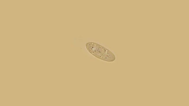 ciliates Param cium under a microscope, protozoa, in the video, internal organs and food are poured with different colors and the work of cilia and vacuus is visible, can be found in any aquarium, is