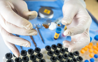 Police expert checks samples chemical as fundamental test in a murder case in crime lab