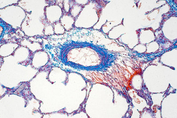 Human lung tissue under microscope view.